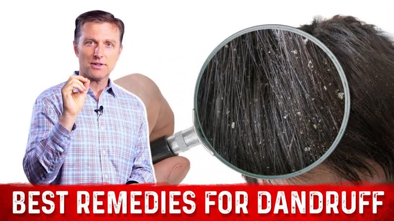Best Natural Home Remedies To Get Rid Of Dandruff Dr.